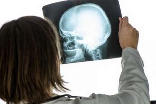 Диагностика перелома основания черепа на рентгене